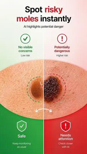 Skin Scanner AI: Mole Check screenshot 1