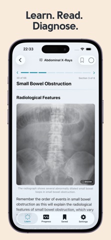 Learn X-Ray Radiology Screenshot 2 of 5