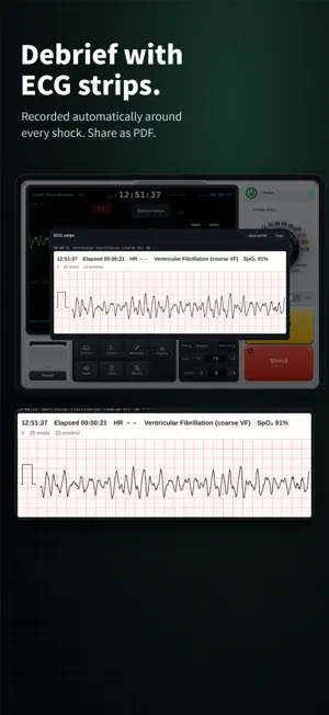 Code Blue Monitor screenshot 4