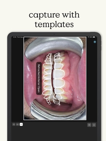 Dental Folio iPad screenshot