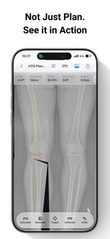 OsteoPlan Screenshot 3 of 10