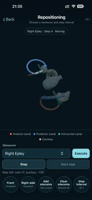 BPPV Simulator screenshot 3