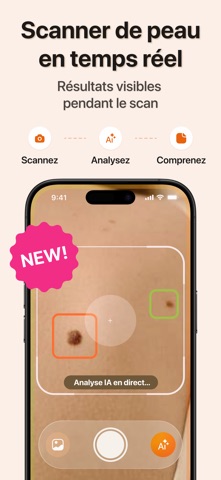 Scanneur Peau: Dermato&beauté iPhone screenshot 2