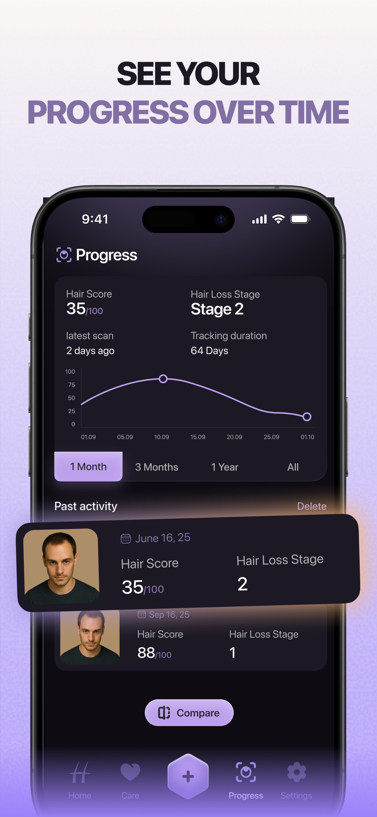 HairLoss AI: Beat Balding