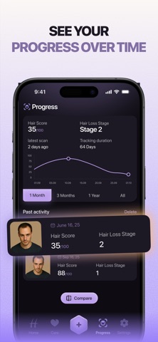 HairLoss AI: Beat Balding screenshot