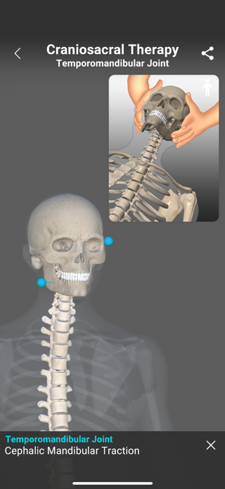 Osteopathy Genius - 3D Maps Screenshot 4 of 7