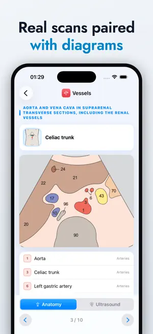 Ultrasound Anatomy Atlas screenshot 3