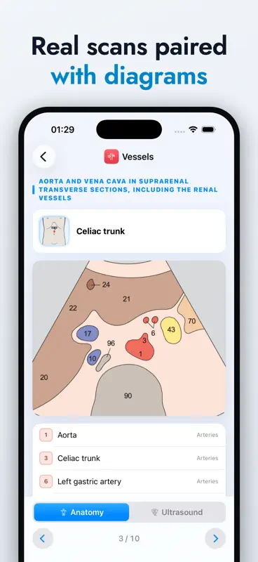 Ultrasound Anatomy Atlas screenshot 3 of 5