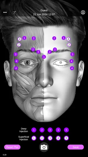 Face Injection Planner screenshot 2
