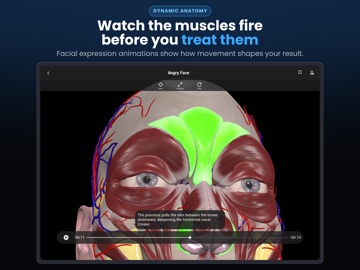 Injectra Screenshot 5
