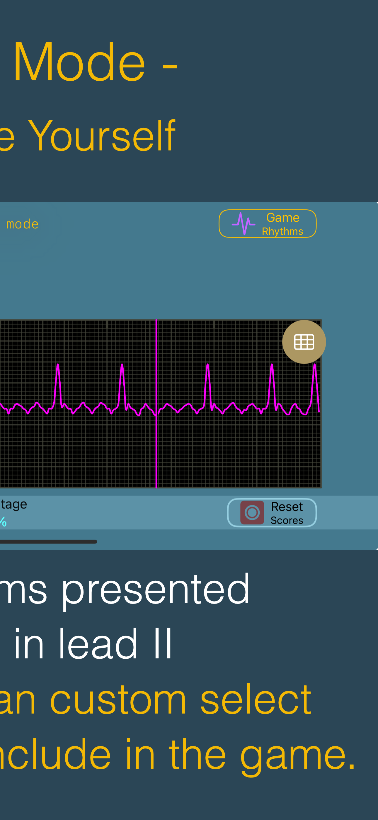arrhythmia
