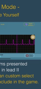 arrhythmia screenshot