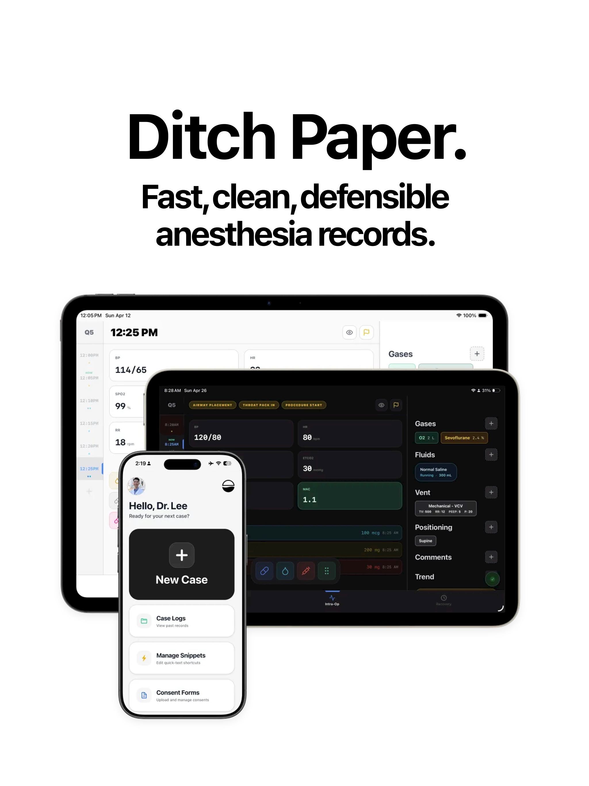 Bolus: Anesthesia Record