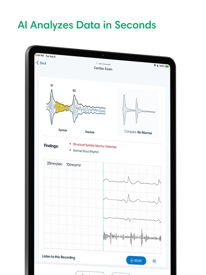 SENSORA™ by Eko Health