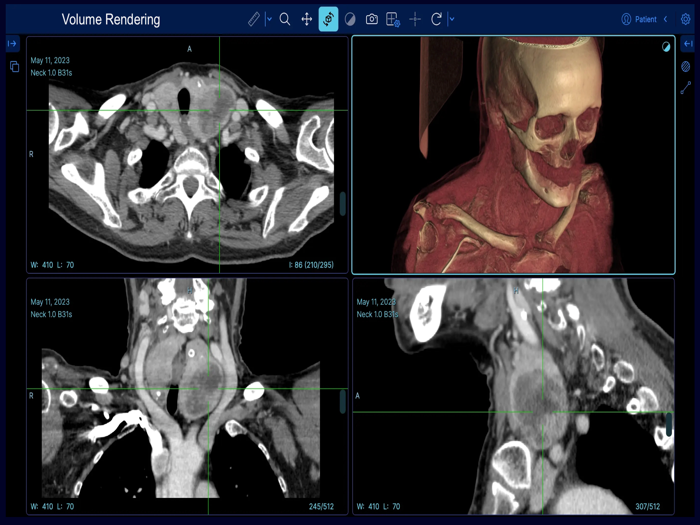 EazyGo  Easy PACS  DICOM