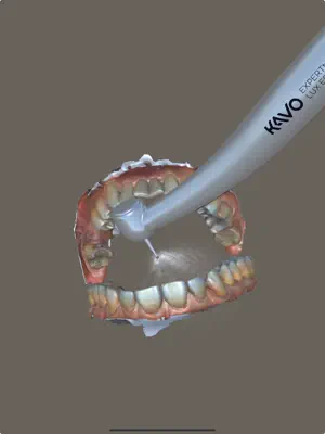 SIMtoCARE Dente Simulator screenshot 2