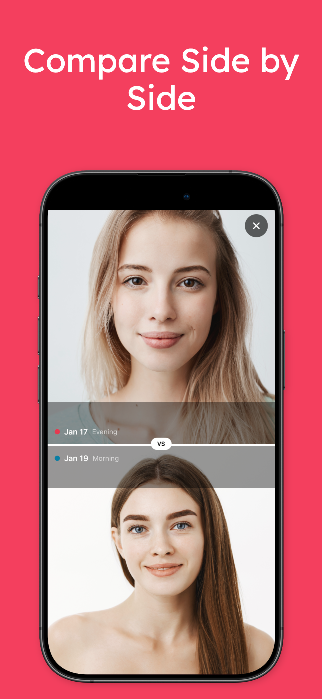 AI Skin Analyzer: SkinJourney screenshot 5
