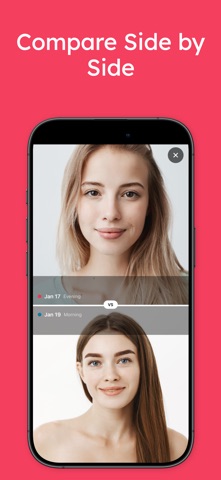 AI Skin Analyzer: SkinJourney iPhone screenshot