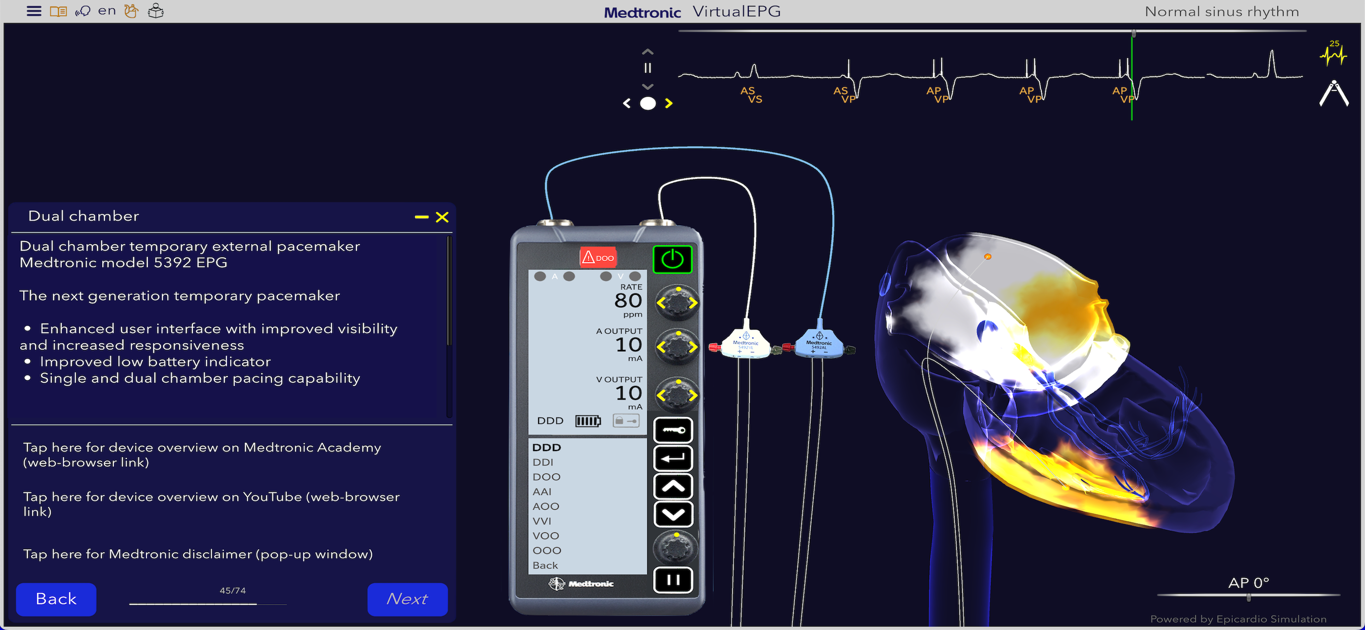 Medtronic VirtualPulse screenshot 9