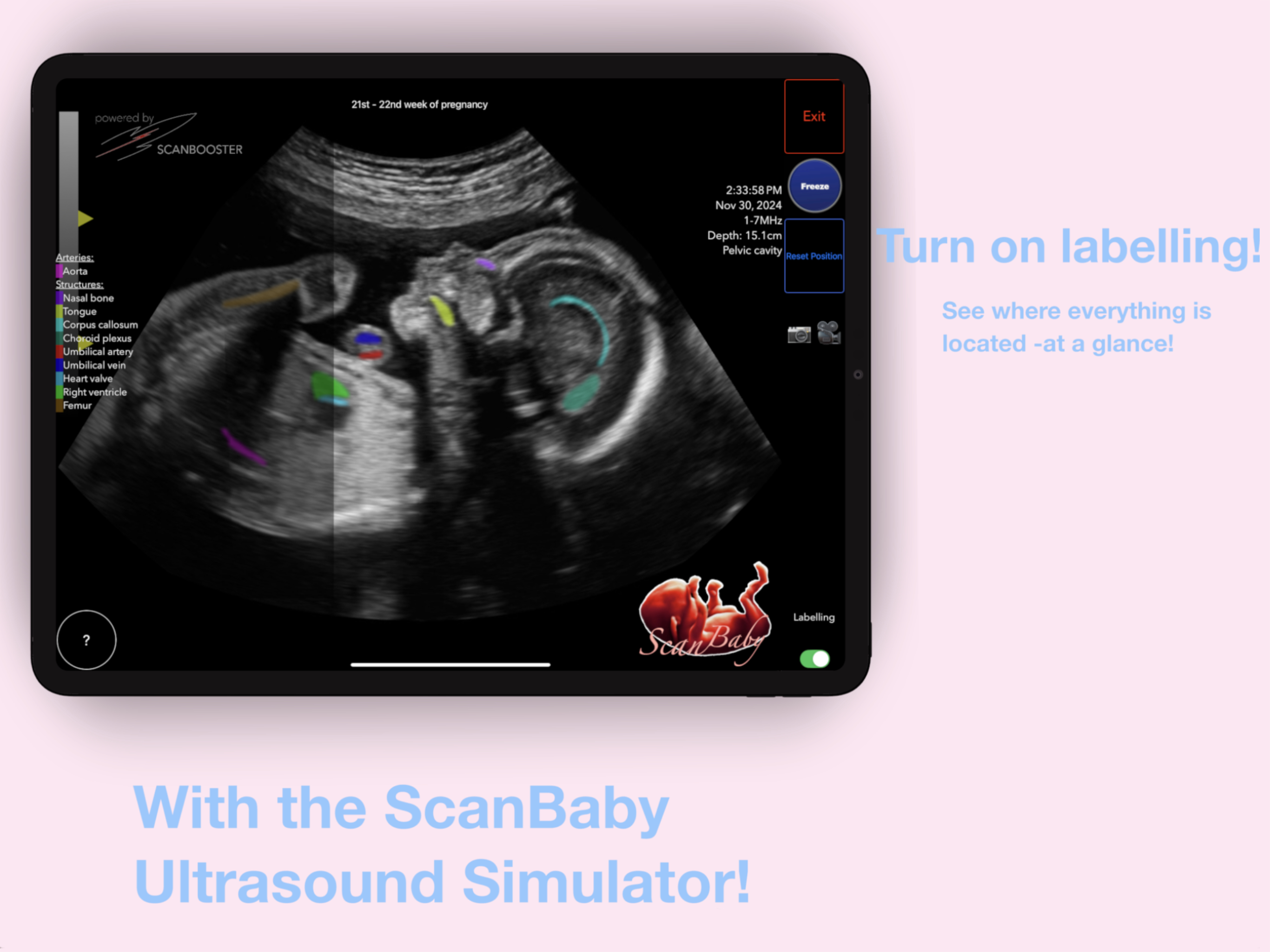 ScanBaby learn baby ultrasound