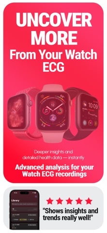 ECG Tracker+ EKG Reader HRV Screenshot 1 of 6