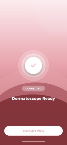 Cecotec Blackhead Remover Pro Screenshot 2 of 3