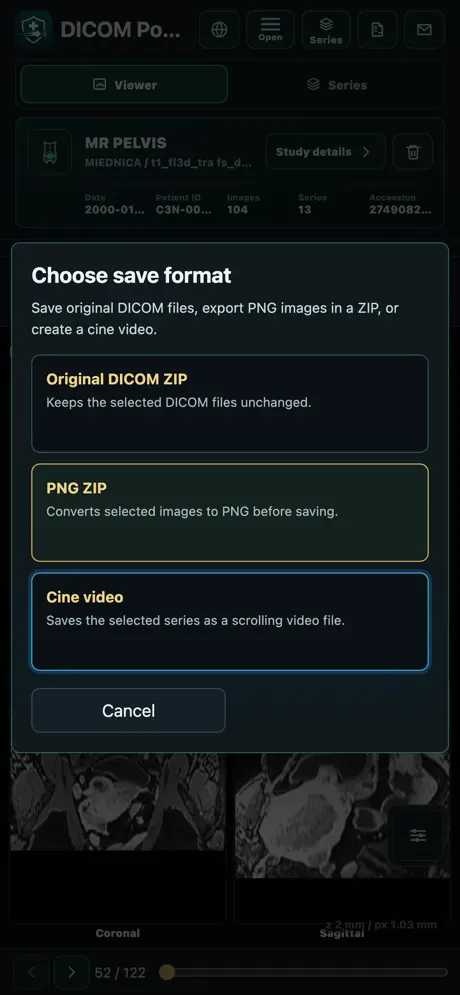 DICOMpocket screenshot 6