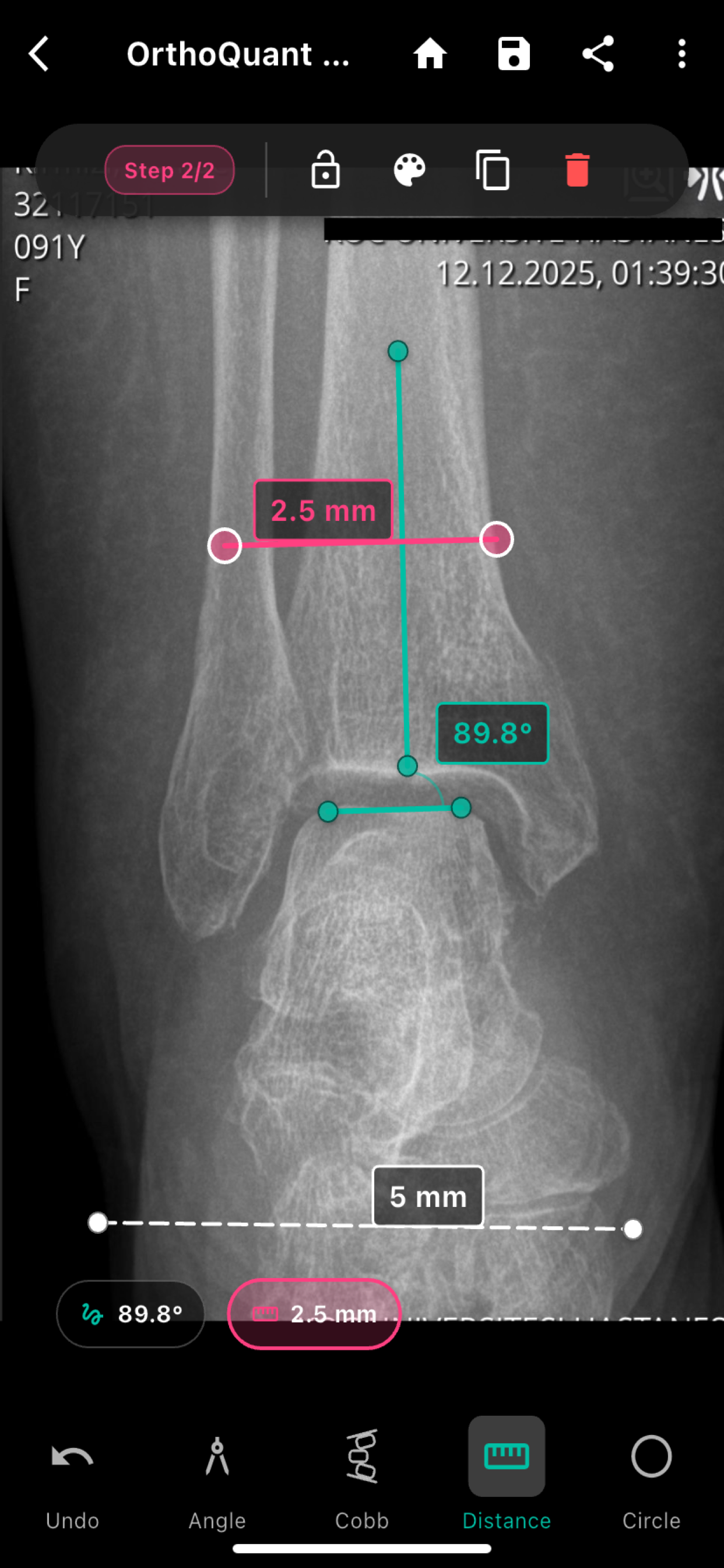 OrthoQuant MD screenshot 7