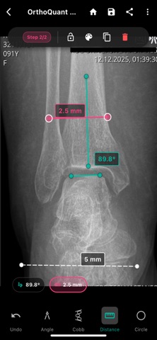 OrthoQuant MD Screenshot 7 of 8