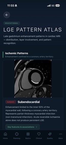 MyoScan IQ: Cardiac MRI Guide screenshot