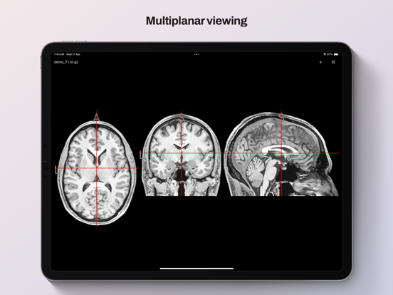 NiiVue iPad screenshot 3 - Medical app