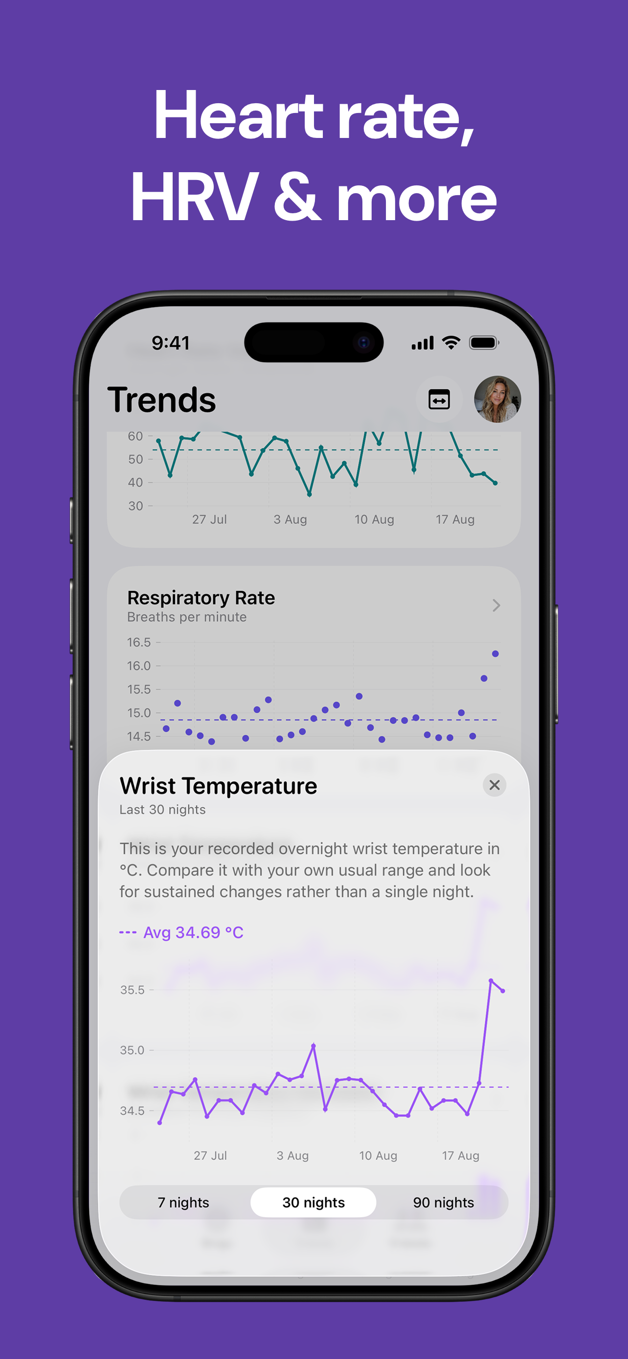 Sleep Rings & Trends: SleepKit screenshot 4