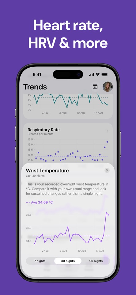 Sleep Rings & Trends: SleepKit screenshot 4