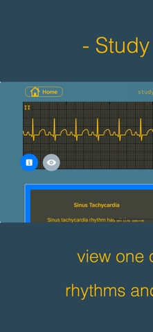 arrhythmia Screenshot 5 of 10