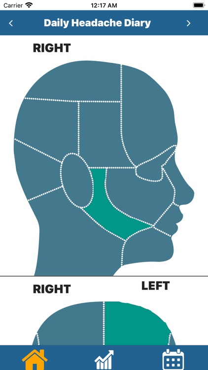 Headache Pro screenshot-5