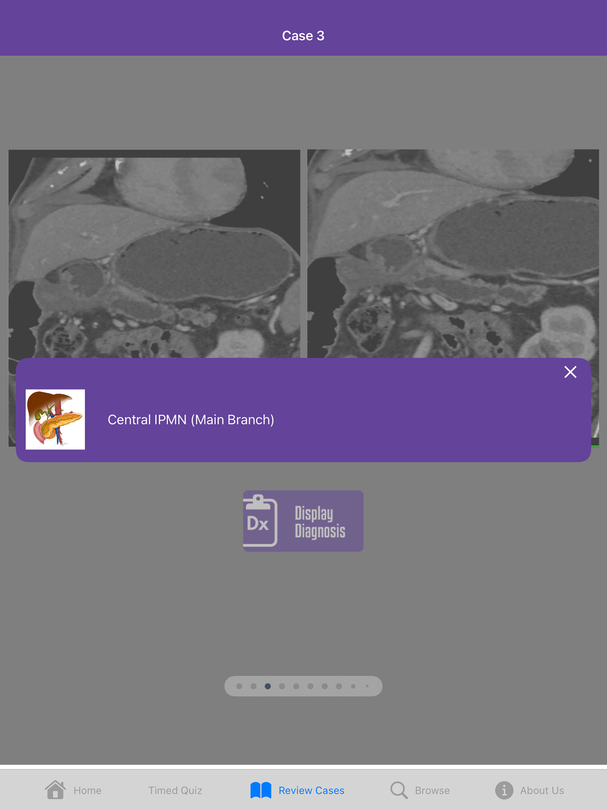 CTisus Pancreas Challenge