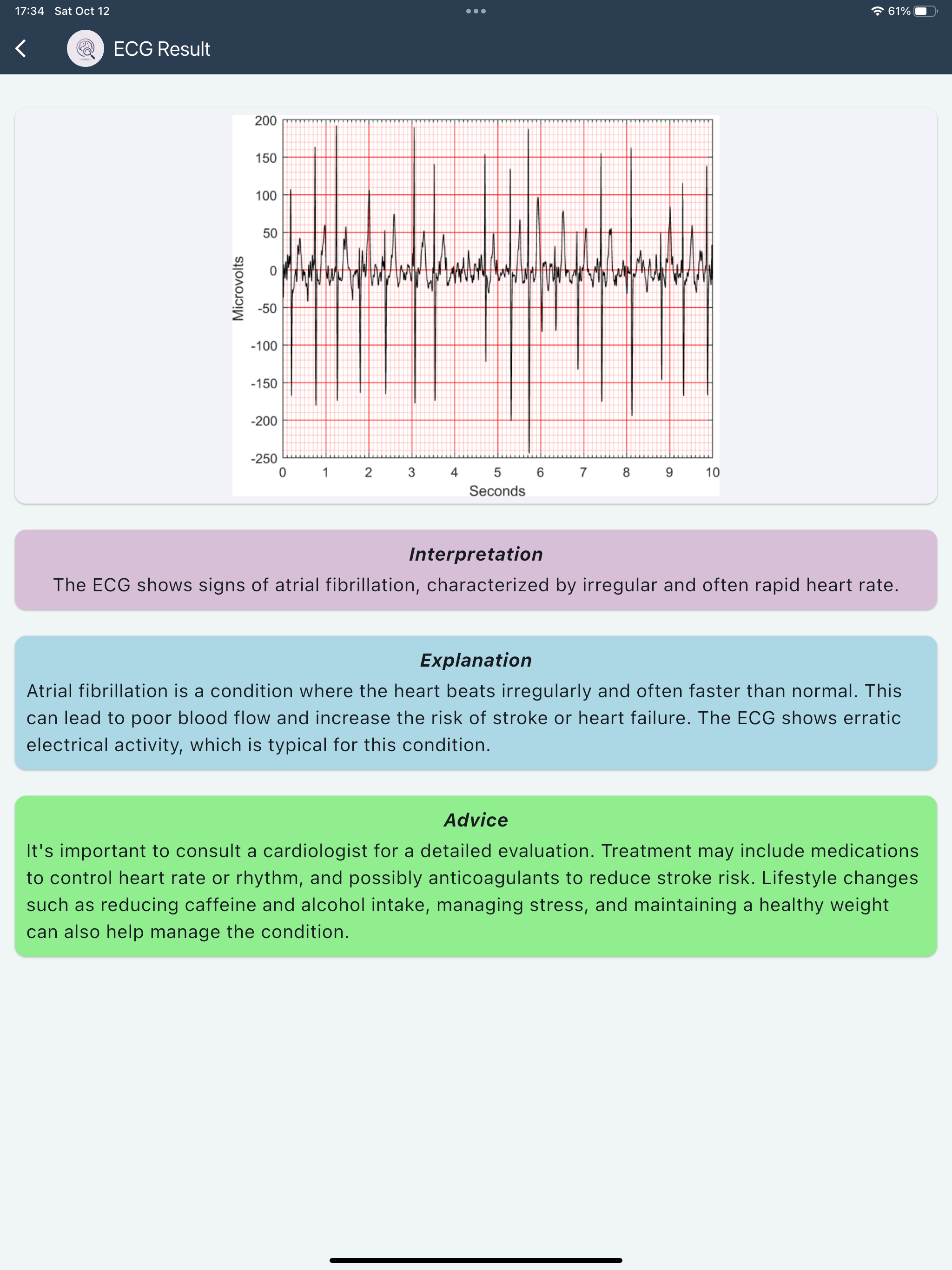 ECG - Smart