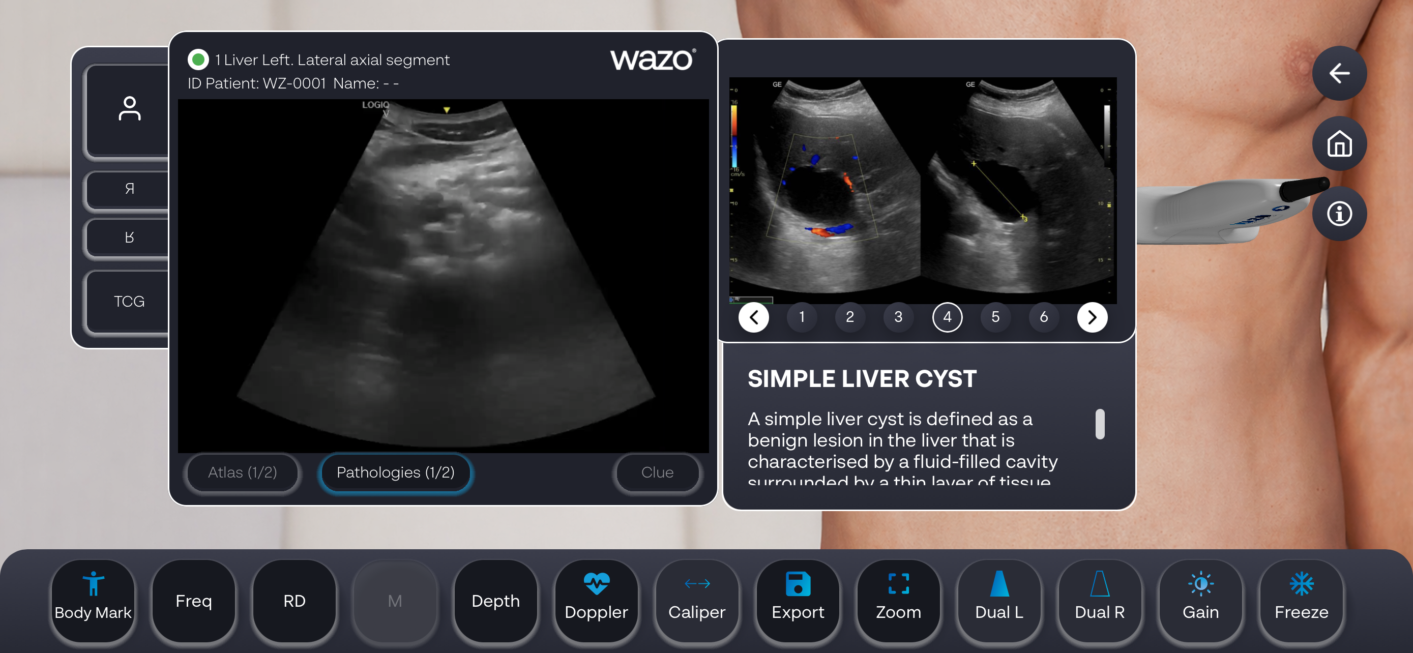 Wazo Ultrasound Simulator screenshot 7