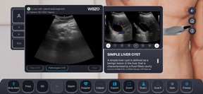 Wazo Ultrasound Simulator screenshot