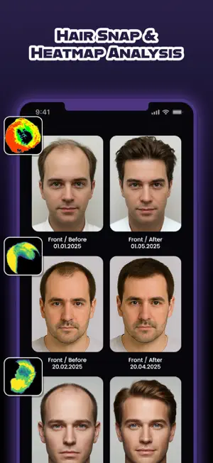 HairCode: AI Hair Loss Scanner screenshot 3