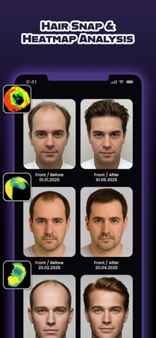 HairCode: AI Hair Loss Scanner screenshot