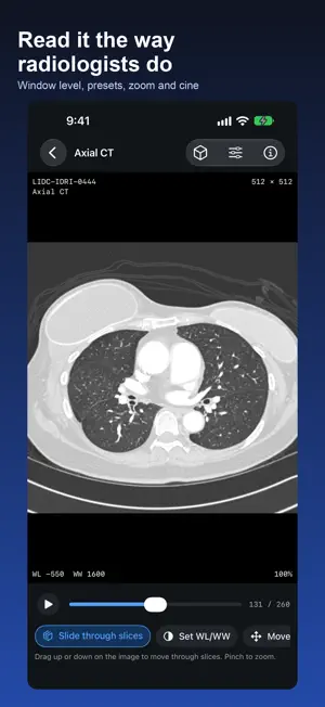 DICOM Viewer: DCM & MRI Reader screenshot 2