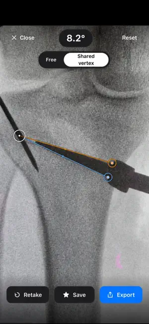 CADtomie IntraOP screenshot 2