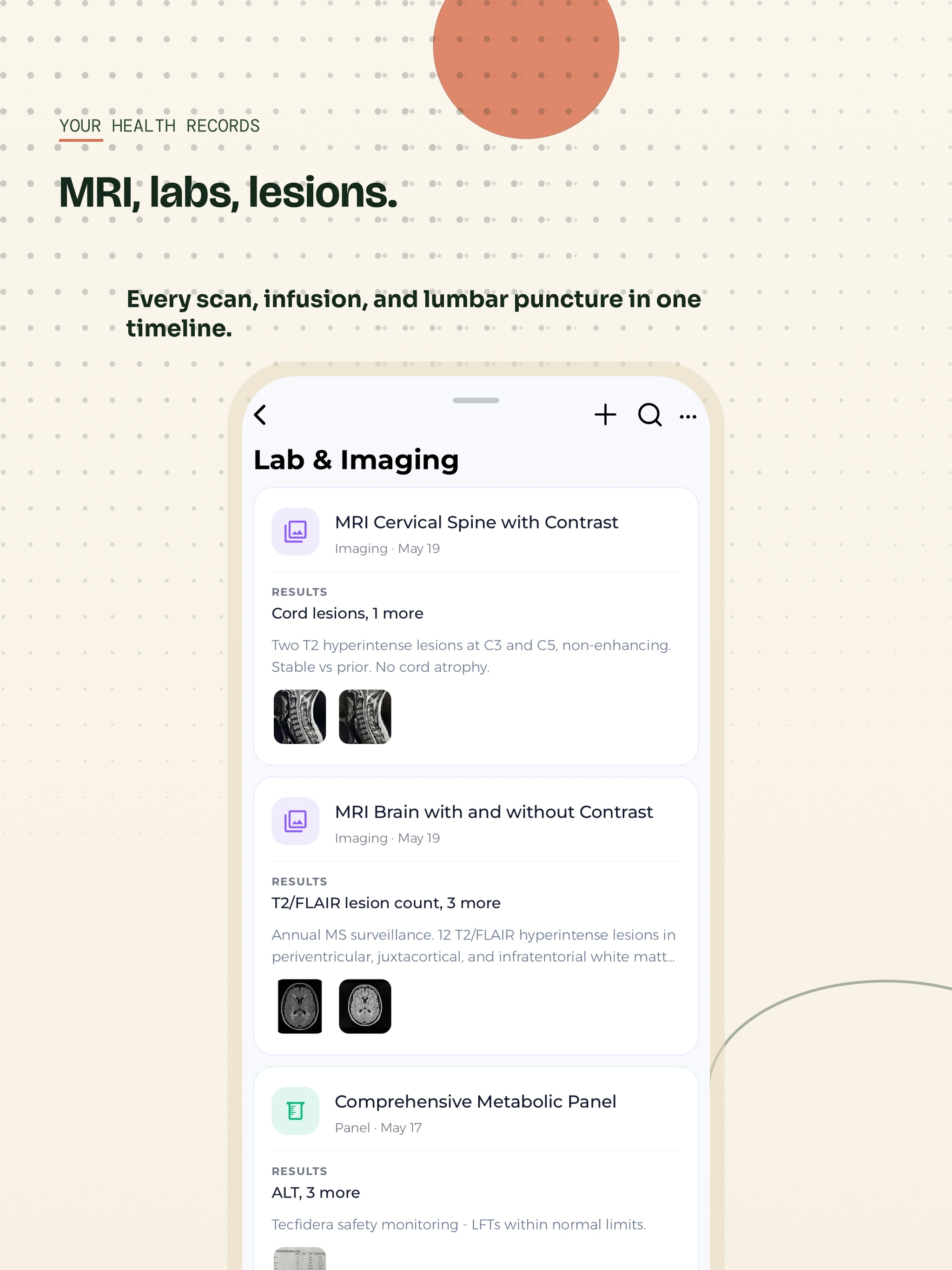Multiple Sclerosis Tracker screenshot 17