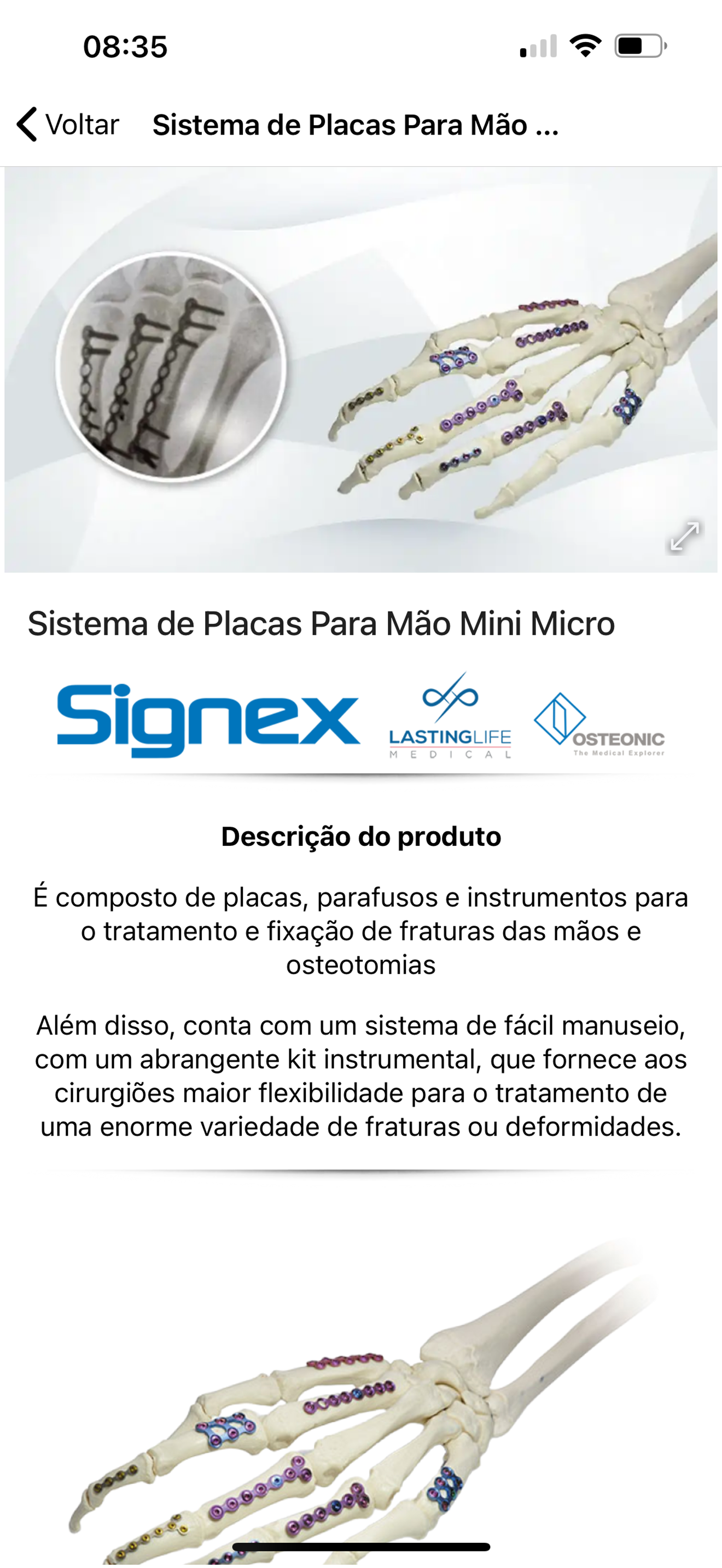 Titanium Produtos Médicos