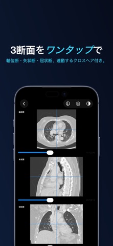 Lumen — DICOM ビューア のスクリーンショット