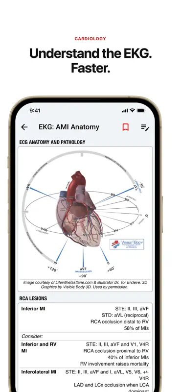 palmEM AI: EM Quick Reference screenshot 8 of 10