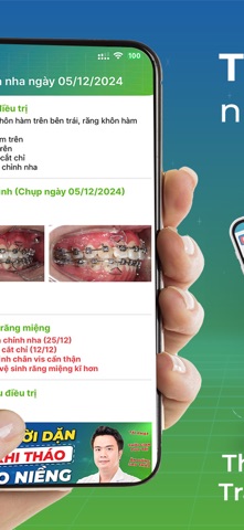 My Braces: Niềng răng Thùy Anh screenshot