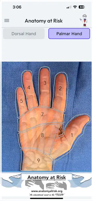 Anatomy at Risk screenshot 2