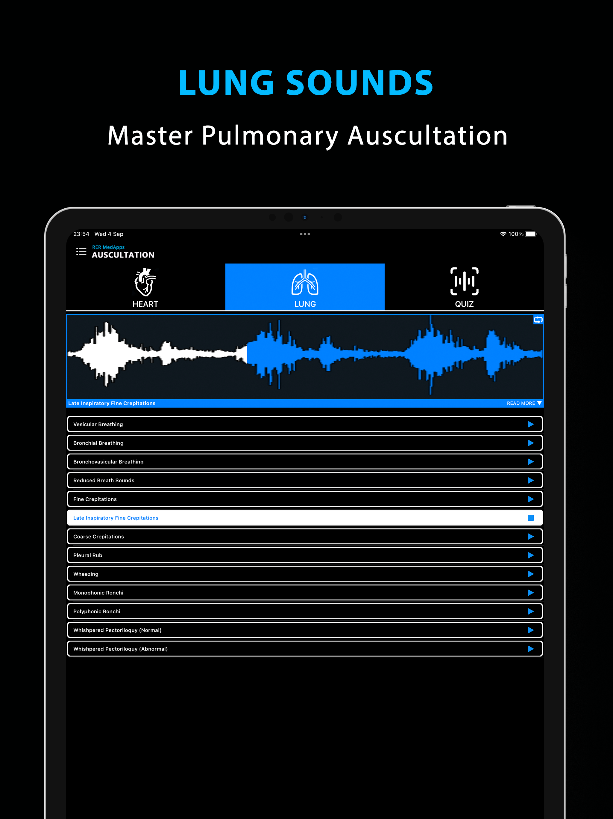 Auscultation - Heart Sounds